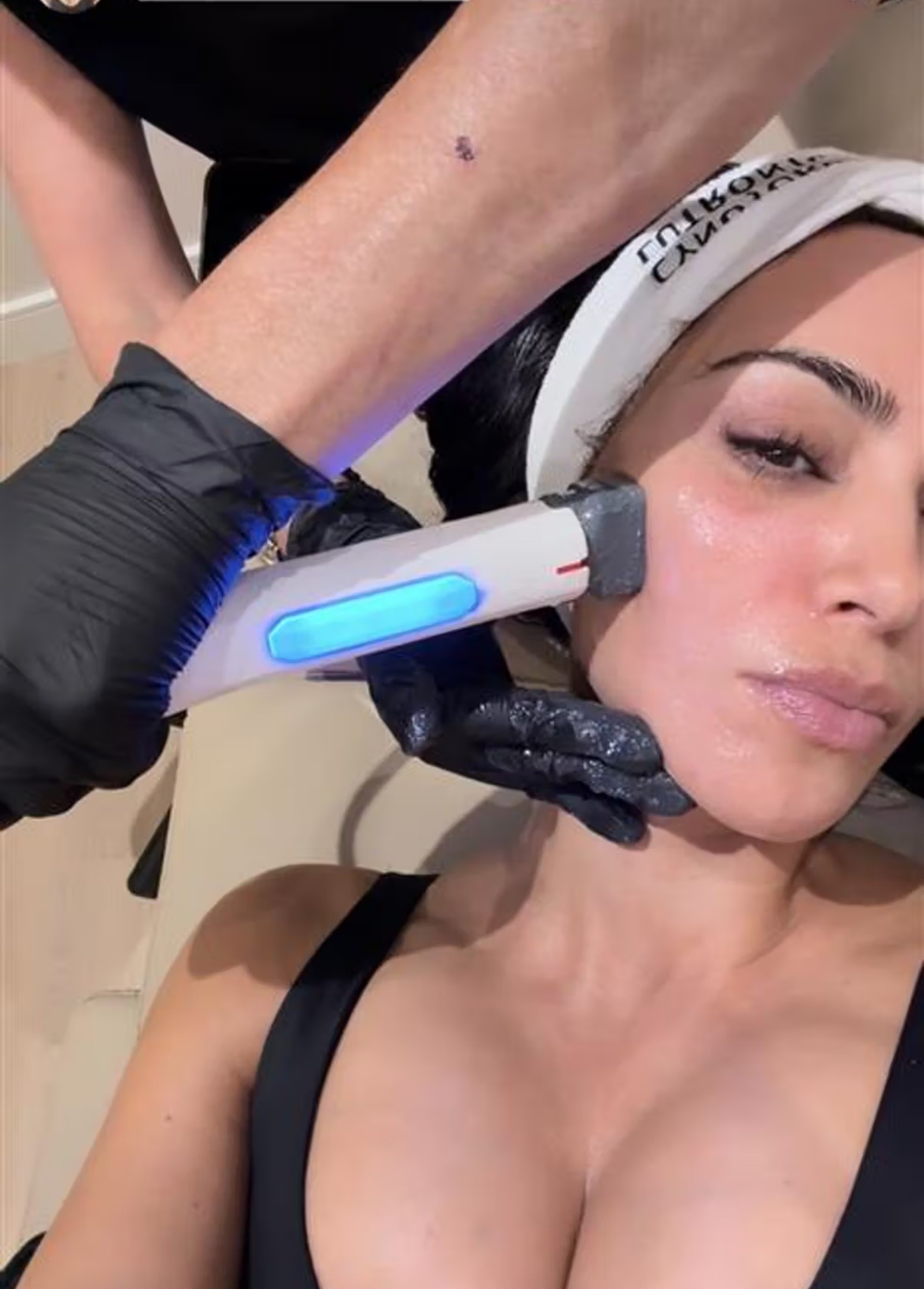 Kim Kardashian e o XERF: a nova febre do rejuvenescimento