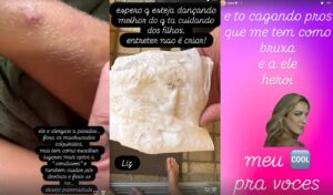 Luana Piovani critica Pedro Scooby após encontrar piolhos