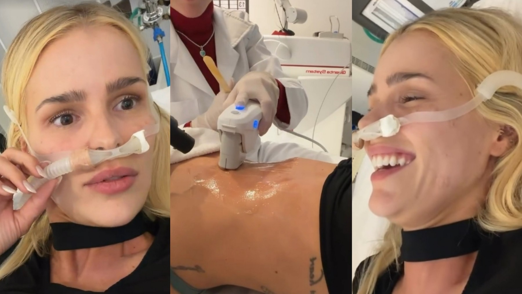 Yasmin Brunet usa sedativo em tratamento no abdômen