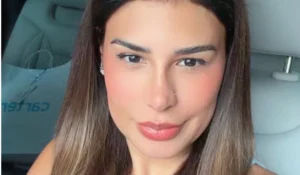 Simone Mendes revela resultado de procedimento em seu nariz